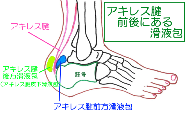 アキレス腱の踵骨付着部には腱をはさむようにして滑液包がある。