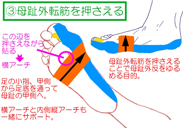 外反母趾テーピング3本目。母趾外転筋を押さえることで外反を緩める目的。 縦アーチと横アーチの補助にもなる。