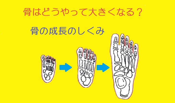 成長板骨折はどのように診断されますか?