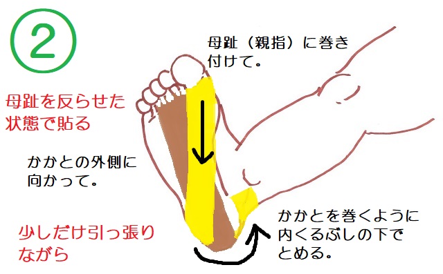 足底腱膜炎テープ2本目。母趾つけ根からかかと外側に向かって貼る。かかとの後ろを巻くようにして内くるぶしの下で止める