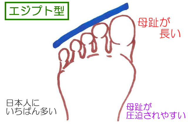 エジプト型のつま先は母趾がいちばん長く日本人に最も多い