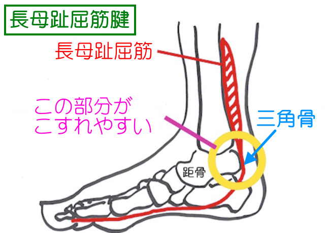 長母趾屈筋腱と距骨後突起と摩擦して三角骨が発生する