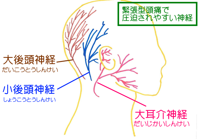 緊張型頭痛では、大後頭神経・小後頭神経・大耳介神経が圧迫されやすく、それらの神経が過敏になって頭痛を発症する