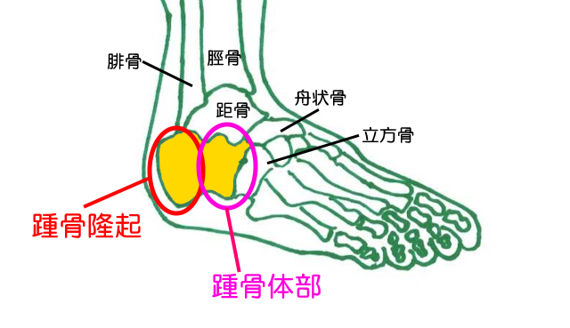 踵骨の前方部分を踵骨体部。後方部分を踵骨隆起と呼ぶ。