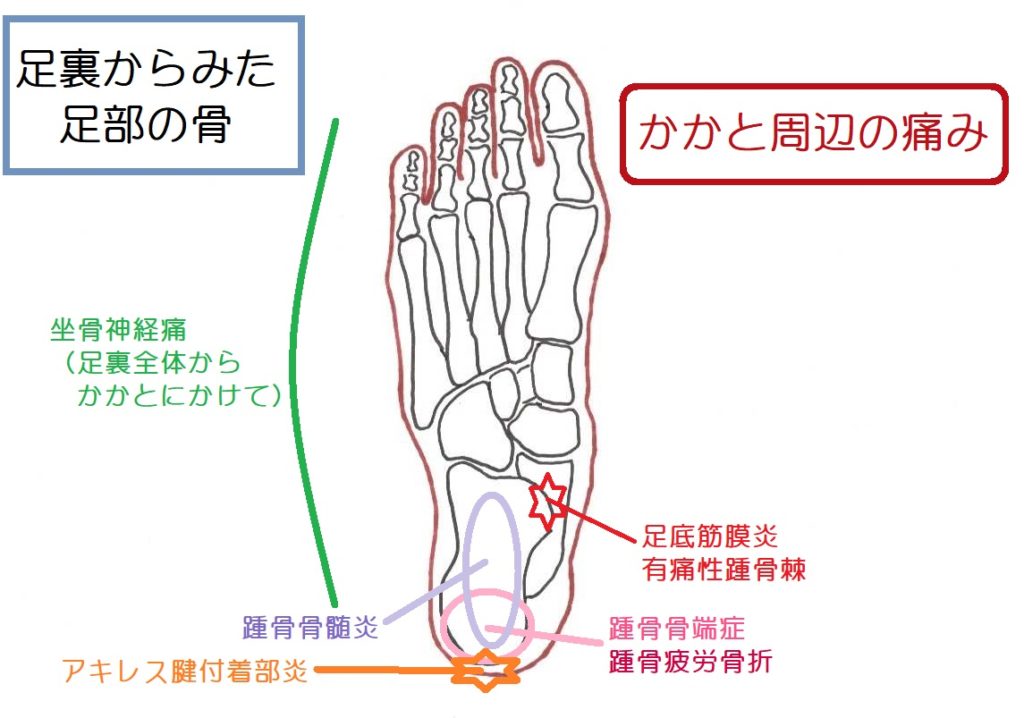 の が 足 痛い かかと 踵の痛み:代表的な７つの症状とその原因