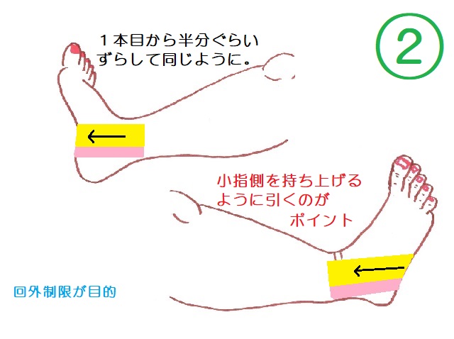腓骨筋しっかり固定テーピング2本目。1本目から半分ずらして内くるぶし→足底→外くるぶしへ。
