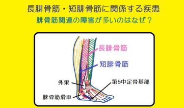 長腓骨筋と短腓骨筋に関係するケガの種類と多い理由5つ