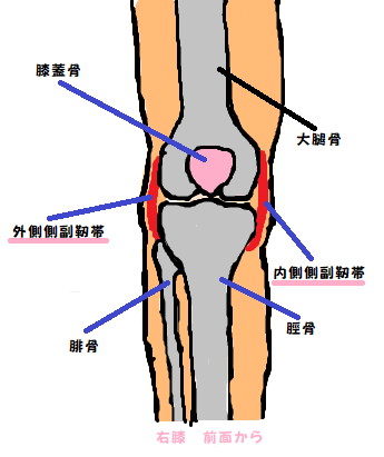 膝の側副靭帯の損傷。後々、変形性関節症の原因にも！