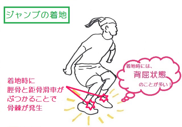 ジャンプの着地で生じる足関節インピンジメント