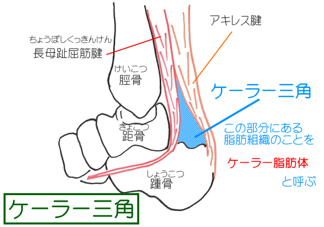 ケーラー三角は、長母指屈筋腱・アキレス腱踵骨に囲まれた三角錐のような形を下部分。内部は脂肪組織で満たされ、ケーラー脂肪体と呼ばれる。
