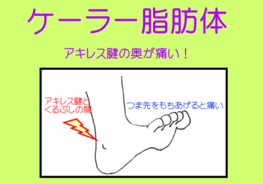 アキレス腱の奥「ケーラー脂肪体」/役割と癒着が引き起こす痛みを徹底解説
