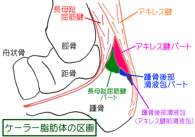 ケーラー脂肪体は、踵骨後部滑液包パート・アキレス腱パート・長母指屈筋腱パートに区分けされている。