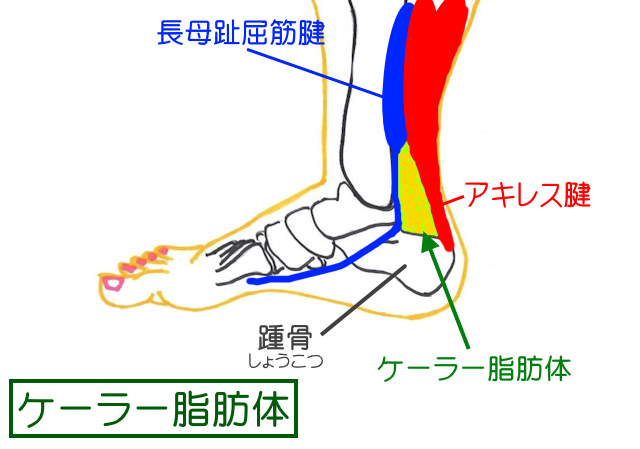 ケーラー脂肪体はアキレス腱、長母指屈筋腱、踵骨に囲まれたケーラーズ三角の中にある脂肪組織のかたまりのこと。