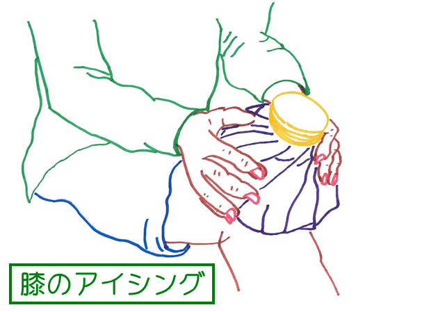 膝のアイシング