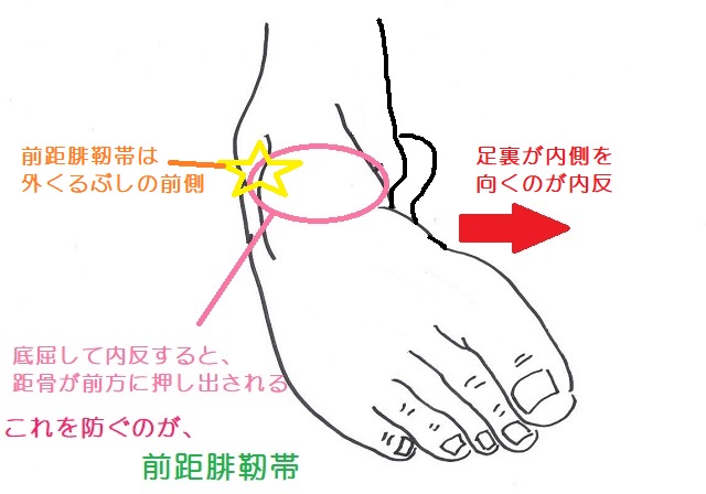 内反捻挫は足裏が内側を向くことで発生する