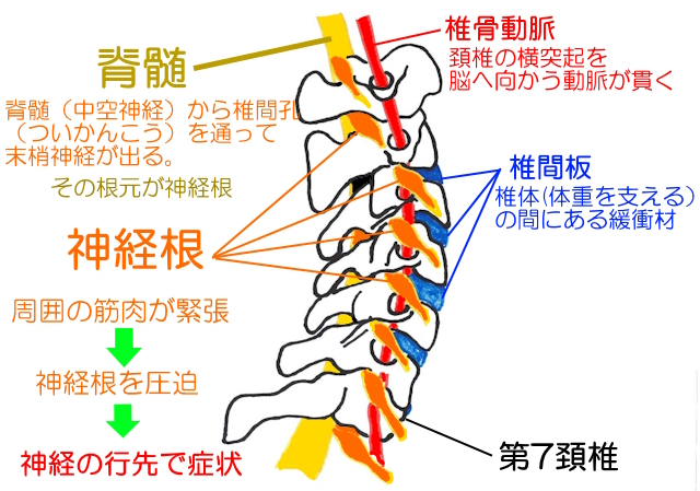 側面から見た頚椎。 脊髄から末梢神経が出る場所が神経根（しんけいこん）。