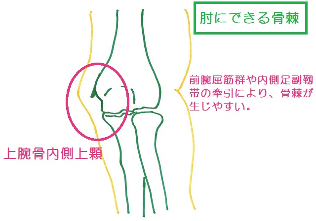 上腕骨内側上顆では内側足副靱帯や前腕屈筋群の牽引で骨棘を生じることがある 