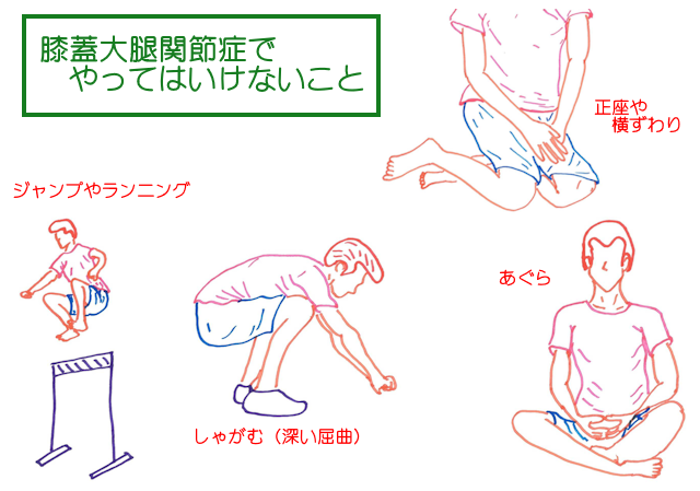 膝蓋大腿関節症では、正座やあぐら横頭割りのほか、しゃがむ、ランニングジャンプは避ける
