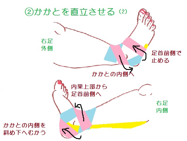 後脛骨筋を保護するテーピング2本目の（2）。内側からも踵骨を支えるようにロックをかける。