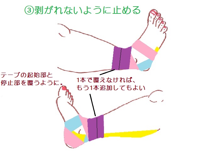 後脛骨筋を保護するテーピング3本目。 ①～②で巻いたテープが剥がれないように起始部と停止部を覆うように貼る