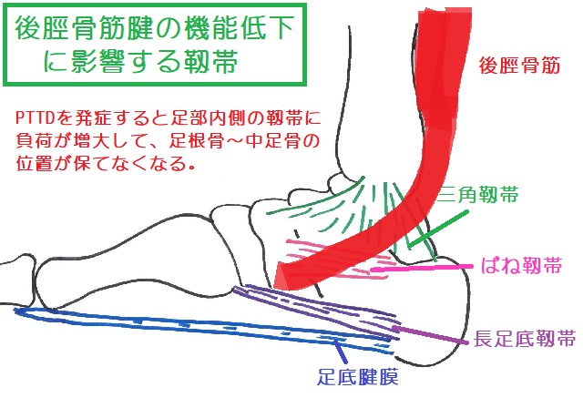 後脛骨筋腱が機能不全に陥ると三角靱帯・ばね靱帯・長足底靱帯・足底腱膜などに負荷が増大する 