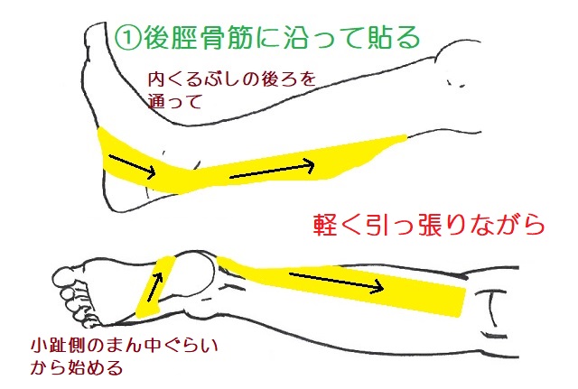 後脛骨筋を補助するテーピング1本目。小趾側から貼り始めて足底を横断。内果後方を上に貼っていく