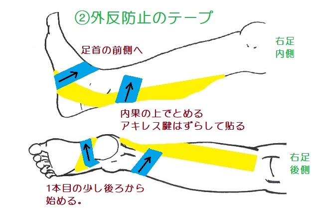 後脛骨筋補助テープ2本目。小趾側から足底を横断して足首前側へ。らせん状に巻いて内くるぶし上部で止める