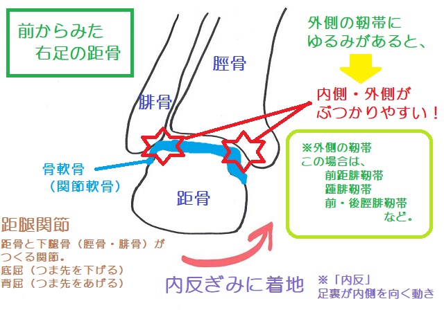足首の離断性骨軟骨炎起きやすい部位