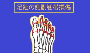 足指の側副靭帯の損傷。足の指をぶつけたときに起きやすい捻挫