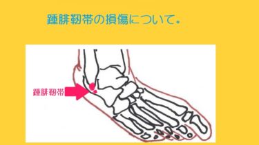 踵腓靭帯（しょうひじんたい）。足首捻挫に合併しやすい靭帯断裂