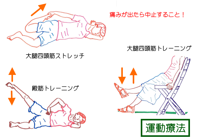 膝蓋大腿関節症では、大腿四頭筋のストレッチ＆トレーニング、殿筋のトレーニングが必要