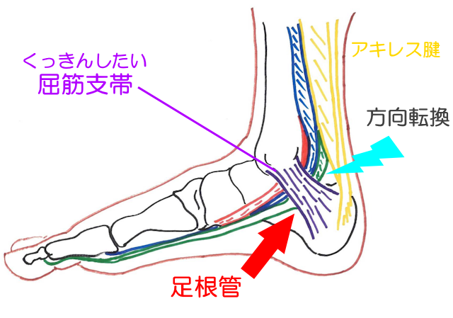 踵骨足根管の位置