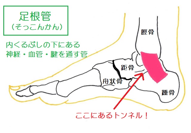 足根管は足裏への神経・血管・腱を通すトンネル